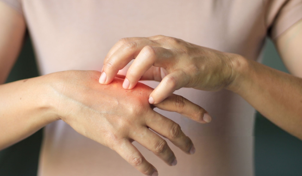 Вплив грибка на організм людини: симптоми